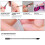 DouborQ UV LED Nagelgel Set & Pusher 2