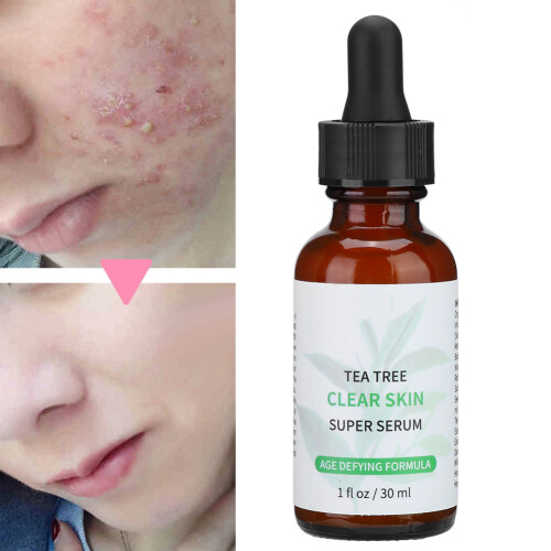 30ml Teebaumöl Serum Ölregulierend Poren Verkleinernd 2