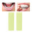 Aligner Chewies Orthodontics Bite Retainer Apples 4