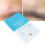 25x Teebaum-Akne-Pflaster für den Tag 4
