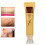 30g Acne Litteken Gel Gezicht & Lichaam 4