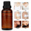 Brusthyperplasie Pflegeöl Schmerzstillend 30ml 4