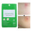 Tea Tree Acne Patch Scar Removal Sticker Daytime Use 5