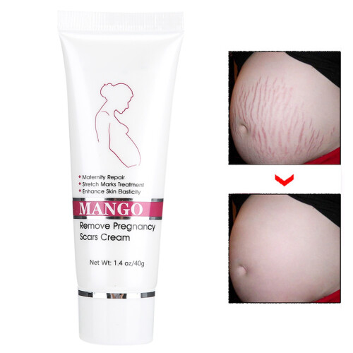 Postpartum Stretch Mark Repair Cream 2