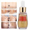Siero Rimozione Smagliature 20ml 5