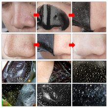 LANBENA 1Pc Blackhead Remover Mask Face Nose Mask Deep Cleansing Mask