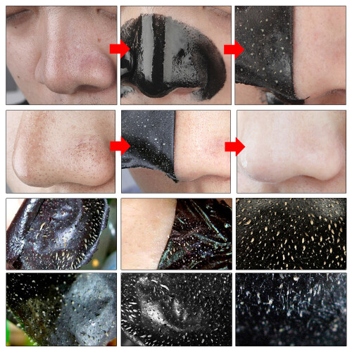 Maschera Nera Rimozione Punti Neri