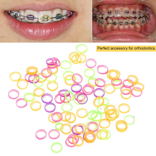 100Pcs Dental Elastic Rubber Bands 4.7mm 1