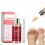 15ML Nagelreparatur-Essenz gegen Pilzbefall 2