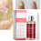 15ML Nagelreparatur-Essenz gegen Pilzbefall 5