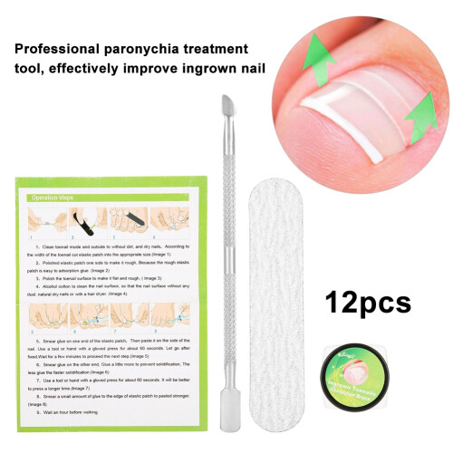 12Pcs Professional Nail Correction Stickers for Pedicure 1
