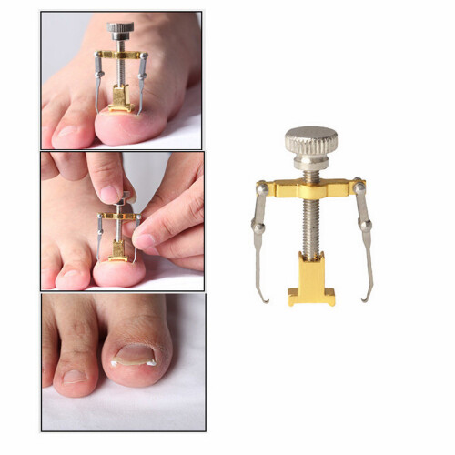 Professionele Ingroeiende Nagel Corrector RVS