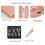 USB Mitesserabsauger Rose Gold 4
