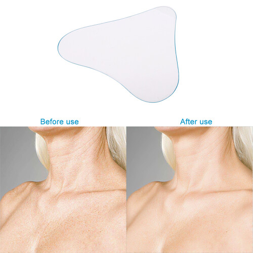 Silikon Anti-Falten Brustpads Selbstklebend 1