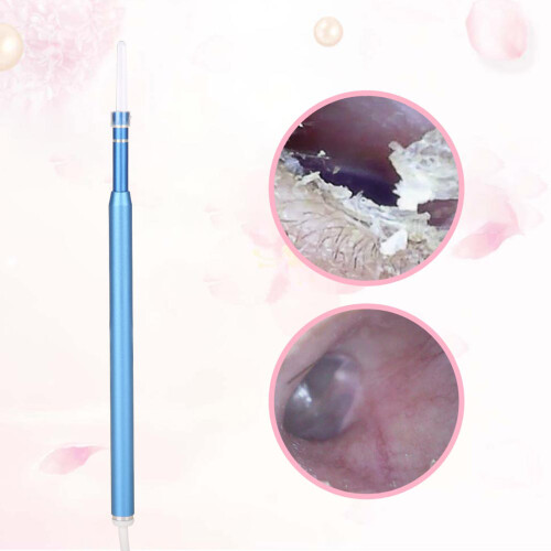 3-in-1 USB Earpick 1.3M Endoscope 2