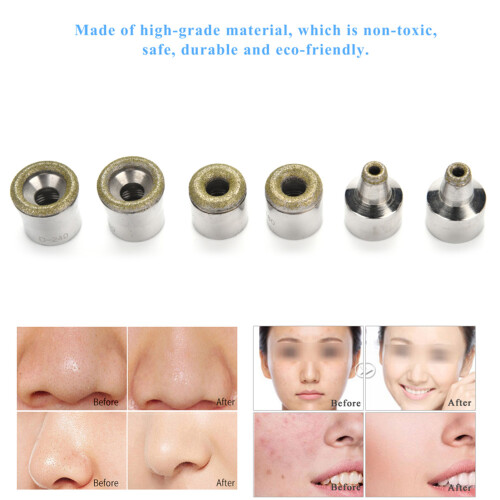 6Pcs Diamond Microdermabrasie Tips RVS Set 2