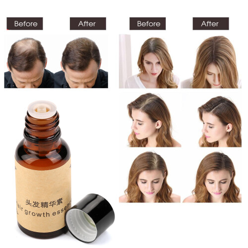 Natürliches Haarwachstumsöl mit Ginseng 1