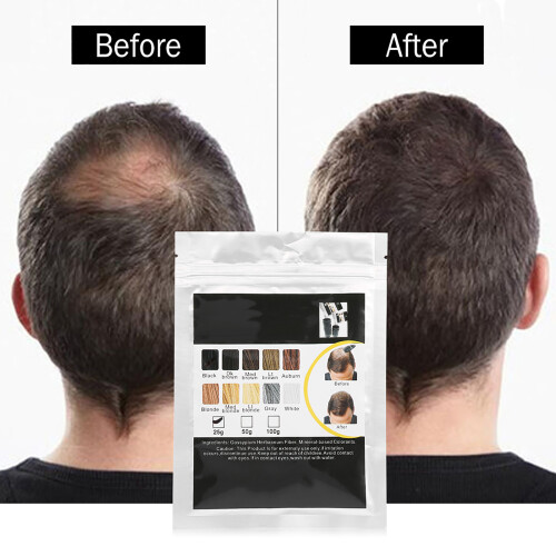 Haarwuchsfaser Verdicker Haarausstopp Schwarz 1