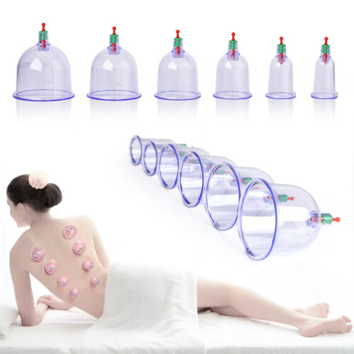 12x Suction Cups Cupping Massage Vacuum Therapy TCM 2