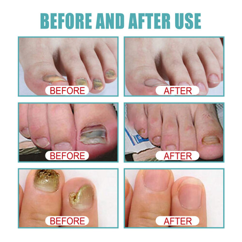 Liquido Unghie 10ml Cura Nutriente 1
