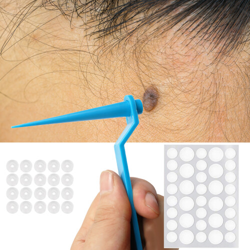 2-in-1 Skin Tag Remover Set Rubber Bands 2-8mm