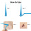 2-in-1 Skin Tag Remover Set Rubber Bands 2-8mm 2