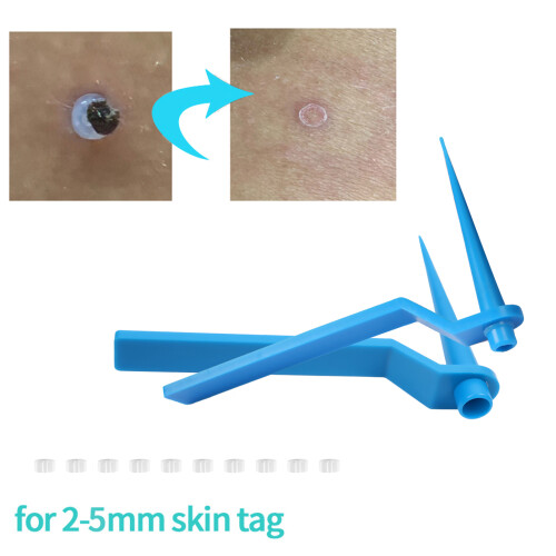 2-in-1 Skin Tag Remover Set Rubber Bands 2-8mm 2