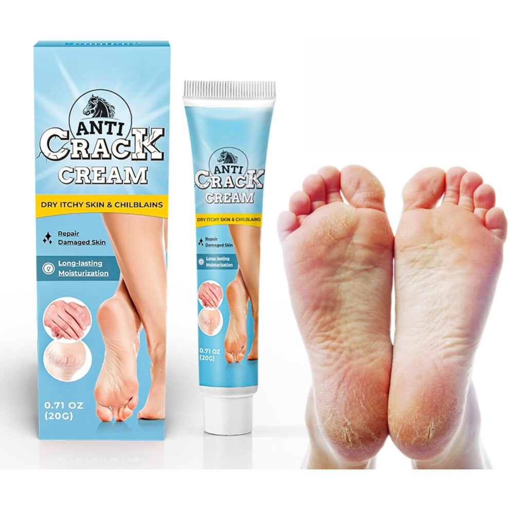 Cream Anti Crack Foot Care For Dry, Itchy Skin & Chilblains, Effective Moisturizing Heel Balm - 20G