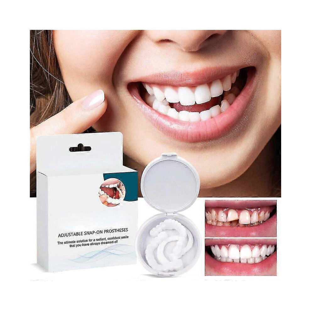 Kikidex (As Show, 2Pairs) Adjustable Snap On Prothesens, Adjustable Snap On Denture, Silicone Whitening Denture Braces, Cover