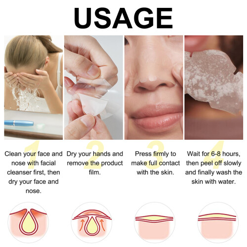 Blackhead Removal Hydrocolloid Nose Strips 12 Pcs 2