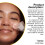 Blackhead Removal Hydrocolloid Nose Strips 12 Pcs 13