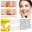 Blackhead Removal Hydrocolloid Nose Strips 12 Pcs 14