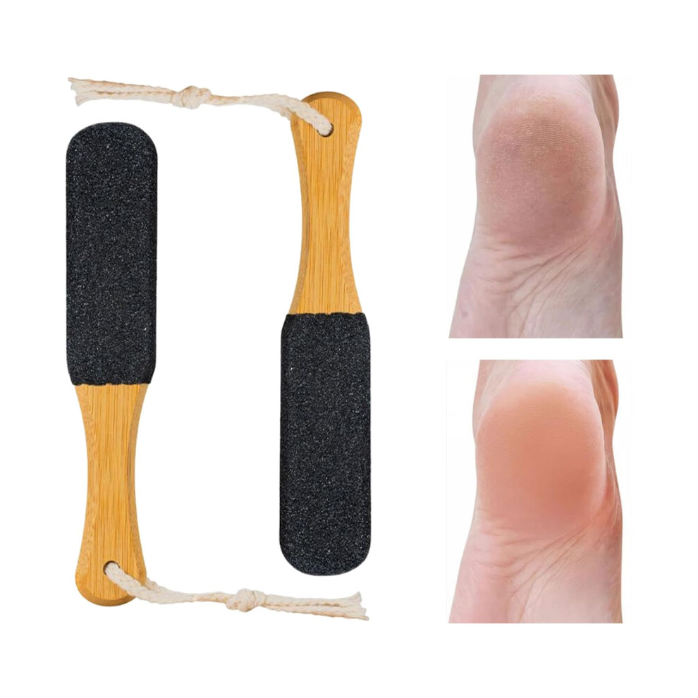 Foot File Scrubber Double Sided Callus Remover Pedicure Tool For Men Senior Athletes Spa Post-Workout Recovery