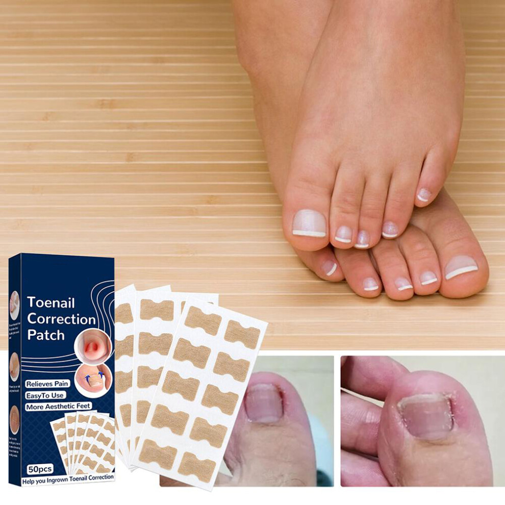 Toenail Corrector Patches for Ingrown Nails - 50Pcs Toenail Care Kit