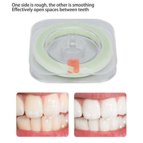 Strisce lucidanti dentali 30µm 2-Zone plastica 2