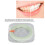 Strisce lucidanti dentali 30µm 2-Zone plastica 4