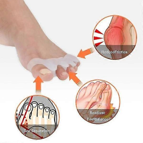 τεμάχια διαστολέας δακτύλων Hallux Valgus που διαχωρίζει τα δάχτυλα των ποδιών, υπ 2