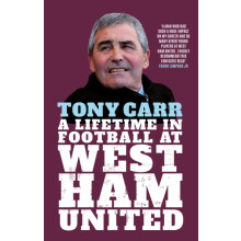 Tony Carr by Tony Carr Hardcover Book