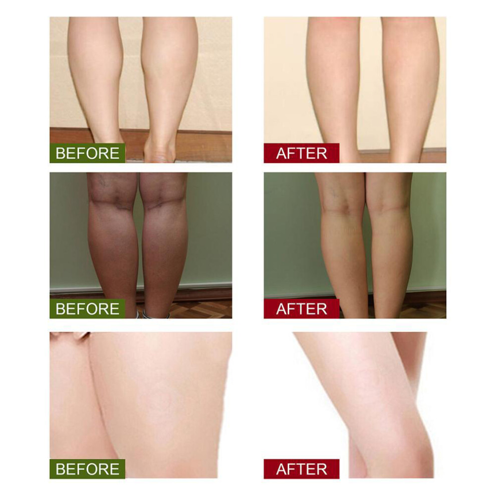 Lymphatic Drainage Ginger Foot Soak, Leg Slimming, Detox, 220g/330g