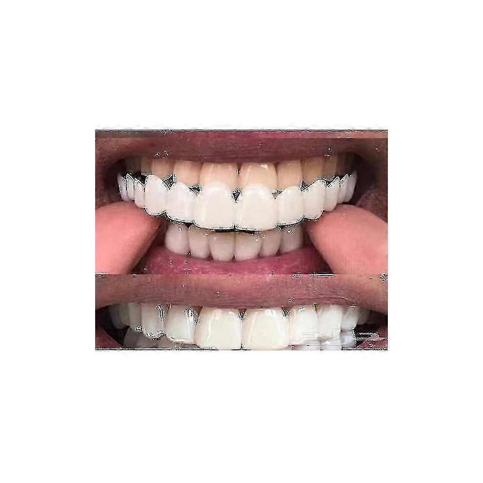 Kikidex (As Show, Upper Lower Teeth) Upper/Lower Comfort Fit Flex Whitening Denture Braces