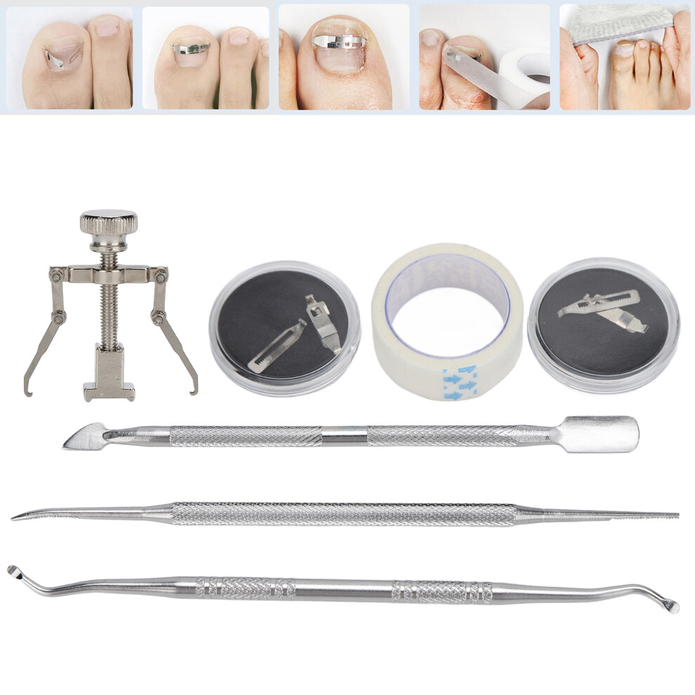 Foot Care Kit: Paronychia Corrector Cuticle Pusher and Nail File
