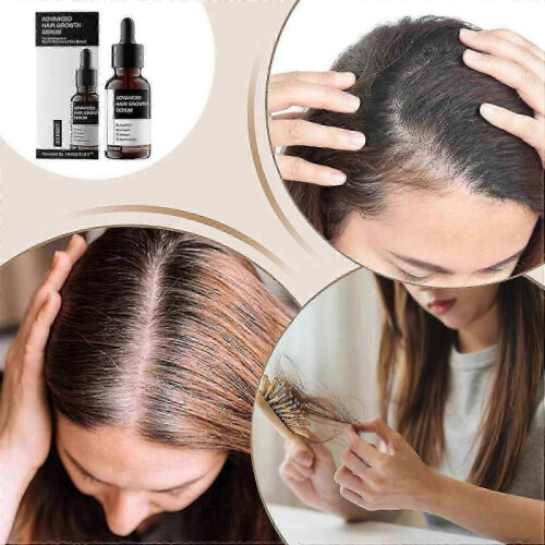 (2pcs)Bare Anatomy Advanced Hair Growth Serum - 30ml 1