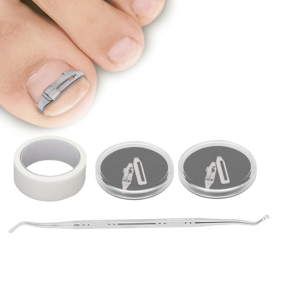 Ingrown Toenail Correction Tool Set â 2 Brace Kits, Medical Tape