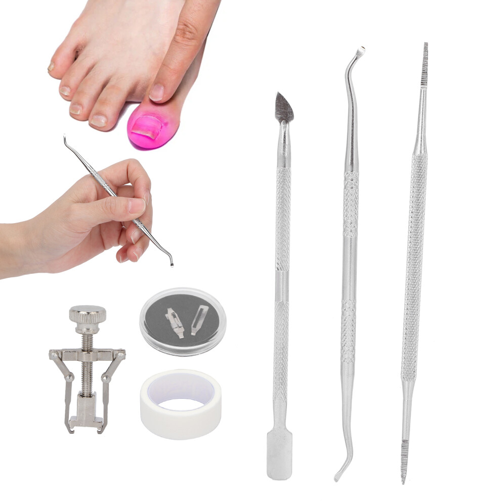 Stainless Steel Ingrown Toenail Corrector Kit with Nail Picker & File