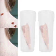 Clip piccole per escrescenze cutanee in rame puro, 2 pezzi, 2,7 cm
