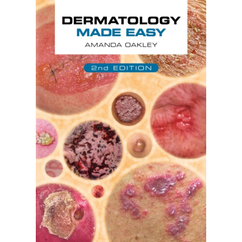 Dermatology Made Easy second edition by Oakley Amanda Honorary Profess