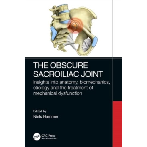 The Obscure Sacroiliac Joint Paperback Book