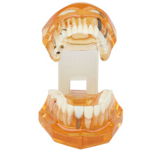 Orange Dental Disease Abnehmbares Studienmodell für Implantatbildung
