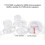 Flange Inserts 17/19/21mm for 24mm-30mm Collection Cup-19mm 4