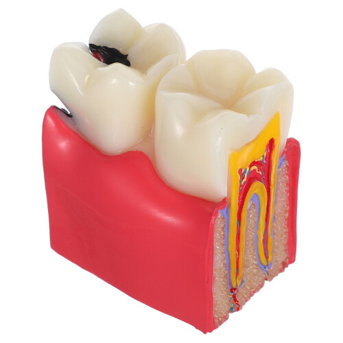 De De Cárie Dentária Com Dentes E Ferramentas Bilaterais